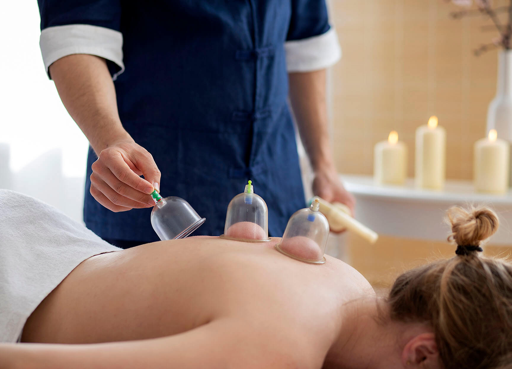 Cupping Therapy at Melbourne Myotherapy Centre